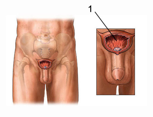 kaip padidinti vyru lyties organu organa